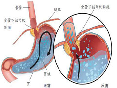 大连胃肠医院
