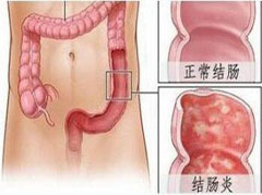 大连胃肠医院