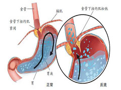 大连胃肠医院